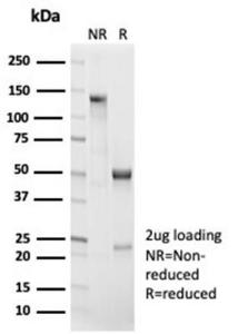 Anti-beta Catenin antibody