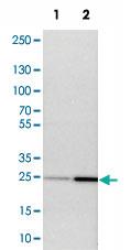 Anti-NDRG3 Rabbit Polyclonal Antibody