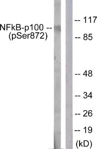 Western blot analysis of lysates from RAW264.7 cells treated with EGF 200 ng/ml 30' using Anti-NF-kappaB p100 (phospho Ser872) Antibody. The right hand lane represents a negative control, where the Antibody is blocked by the immunising peptide