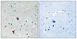 Immunohistochemical analysis of paraffin-embedded human brain tissue using Anti-OXR1 Antibody. The right hand panel represents a negative control, where the Antibody was pre-incubated with the immunising peptide