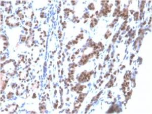 Immunohistochemical analysis of formalin-fixed, paraffin-embedded human thyroid using Anti-TTF1 Antibody [rNX2.1/690]