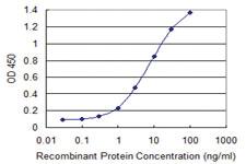 Anti-HSFY1 Mouse Monoclonal Antibody [clone: 1D2]