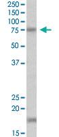 Anti-TGM7 Goat Polyclonal Antibody