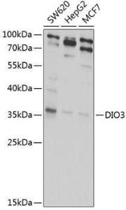 Western blot analysis of extracts of various cell lines, using Anti-Dio3 Antibody (A10023) at 1:1,000 dilution The secondary antibody was Goat Anti-Rabbit IgG H&L Antibody (HRP) at 1:10,000 dilution Lysates/proteins were present at 25 µg per lane