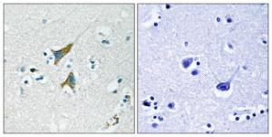 Immunohistochemical analysis of paraffin-embedded human brain tissue using Anti-MKP1 Antibody. The right hand panel represents a negative control, where the Antibody was pre-incubated with the immunising peptide