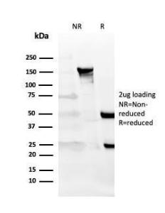 SDS-PAGE analysis of Anti-CD27 Antibody [LPFS2/4177] under non-reduced and reduced conditions; showing intact IgG and intact heavy and light chains, respectively. SDS-PAGE analysis confirms the integrity and purity of the antibody.