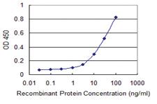 Anti-TAGLN Mouse Monoclonal Antibody [clone: 1E2]