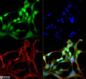 Anti-FTCD Mouse Monoclonal Antibody [clone: 58K-9]