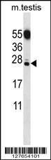 Anti-CT011 Rabbit Polyclonal Antibody (APC (Allophycocyanin))