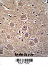 Anti-TP53INP1 Rabbit Polyclonal Antibody (APC (Allophycocyanin))