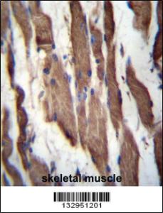 Anti-TGFBRAP1 Rabbit Polyclonal Antibody