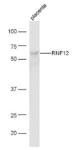 Anti-RLIM Rabbit Polyclonal Antibody