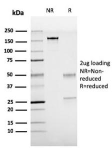 SDS-PAGE analysis of Anti-TTF1 Antibody [rNX2.1/690] under non-reduced and reduced conditions; showing intact IgG and intact heavy and light chains, respectively. SDS-PAGE analysis confirms the integrity and purity of the antibody