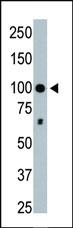 Anti-HDAC4 Rabbit Polyclonal Antibody