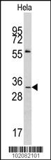 Anti-MAGEA1 Rabbit Polyclonal Antibody