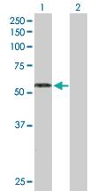 Anti-RAG2 Rabbit Polyclonal Antibody