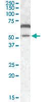 Anti-CAMK2A Goat Polyclonal Antibody