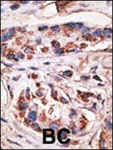 Anti-MAGEA1 Rabbit Polyclonal Antibody