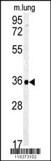 Anti-TERF2 Rabbit Polyclonal Antibody