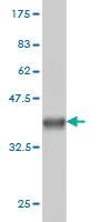 Anti-ADCK3 Mouse Monoclonal Antibody [clone: 6G10]