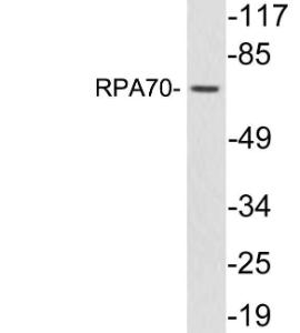 Western blot analysis of lysates from COLO205 cells using Anti-RPA70 Antibody