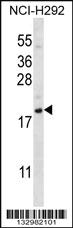 Anti-CXCL12 Rabbit Polyclonal Antibody