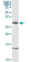 Anti-RAG2 Rabbit Polyclonal Antibody