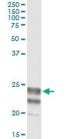 Anti-NAAA Antibody Pair