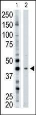 Anti-ART3 Rabbit Polyclonal Antibody (AP (Alkaline Phosphatase))