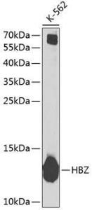 Western blot analysis of extracts of K-562 cells, using Anti-Hemoglobin subunit zeta Antibody (A10026) at 1:1000 dilution