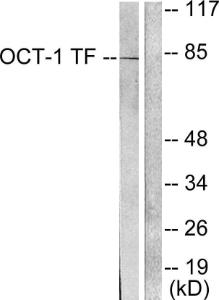 Western blot analysis of lysates from HeLa cells using Anti-OCT1 Antibody. The right hand lane represents a negative control, where the Antibody is blocked by the immunising peptide