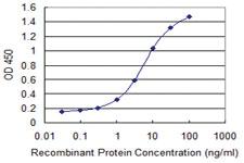 Anti-ZNF224 Mouse Monoclonal Antibody [clone: 2C12]