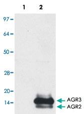 Anti-AGR2 + AGR3 Mouse Monoclonal Antibody [clone: AGR3.4]