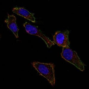 Immunofluorescent analysis of SK-OV-3 cells stained with Anti-EpCAM Antibody [EGP40/826] (AF488) (Green). DyLight 554 Phalloidin labeled F-actin filaments (Red). DAPI stained nuclei (Blue).