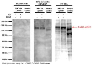 Anti-TrkB (phospho Y816/Y817) Rabbit Polyclonal Antibody