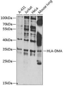 Western blot analysis of extracts of various cell lines, using Anti-HLA DMA Antibody (A10027) at 1:1,000 dilution