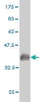 Anti-ADCK3 Mouse Monoclonal Antibody [clone: 7G1]