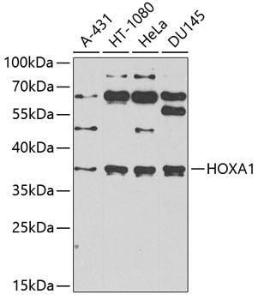 Western blot analysis of extracts of various cell lines, using Anti-HOXA1 Antibody (A10029) at 1:1,000 dilution