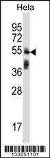 Anti-TRIM38 Rabbit Polyclonal Antibody