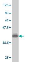 Anti-ADCK3 Mouse Monoclonal Antibody [clone: 8F7]