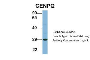 Anti-CENPQ Rabbit Polyclonal Antibody