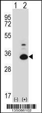 Anti-TP53RK Rabbit Polyclonal Antibody (Biotin)