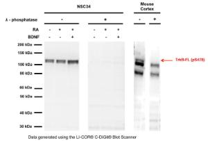 Anti-TrkB (phospho-Ser478) Rabbit Polyclonal Antibody