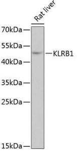 Western blot analysis of extracts of rat liver, using Anti-CD161 Antibody (A10030) at 1:3,000 dilution. The secondary antibody was Goat Anti-Rabbit IgG H&L Antibody (HRP) at 1:10,000 dilution.