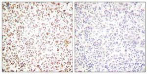 Immunohistochemical analysis of paraffin-embedded human lymph node tissue using Anti-OCT1 Antibody. The right hand panel represents a negative control, where the Antibody was pre-incubated with the immunising peptide