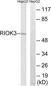 Western blot analysis of lysates from HepG2 cells using Anti-RIOK3 Antibody. The right hand lane represents a negative control, where the antibody is blocked by the immunising peptide