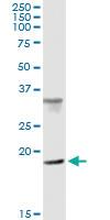 Anti-CENPM Polyclonal Antibody Pair