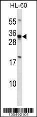 Anti-HOXB8 Rabbit Polyclonal Antibody (HRP (Horseradish Peroxidase))