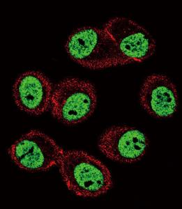 Anti-BMI1 Rabbit Polyclonal Antibody (FITC (Fluorescein))