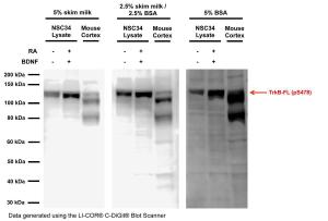 Anti-TrkB (phospho-Ser478) Rabbit Polyclonal Antibody